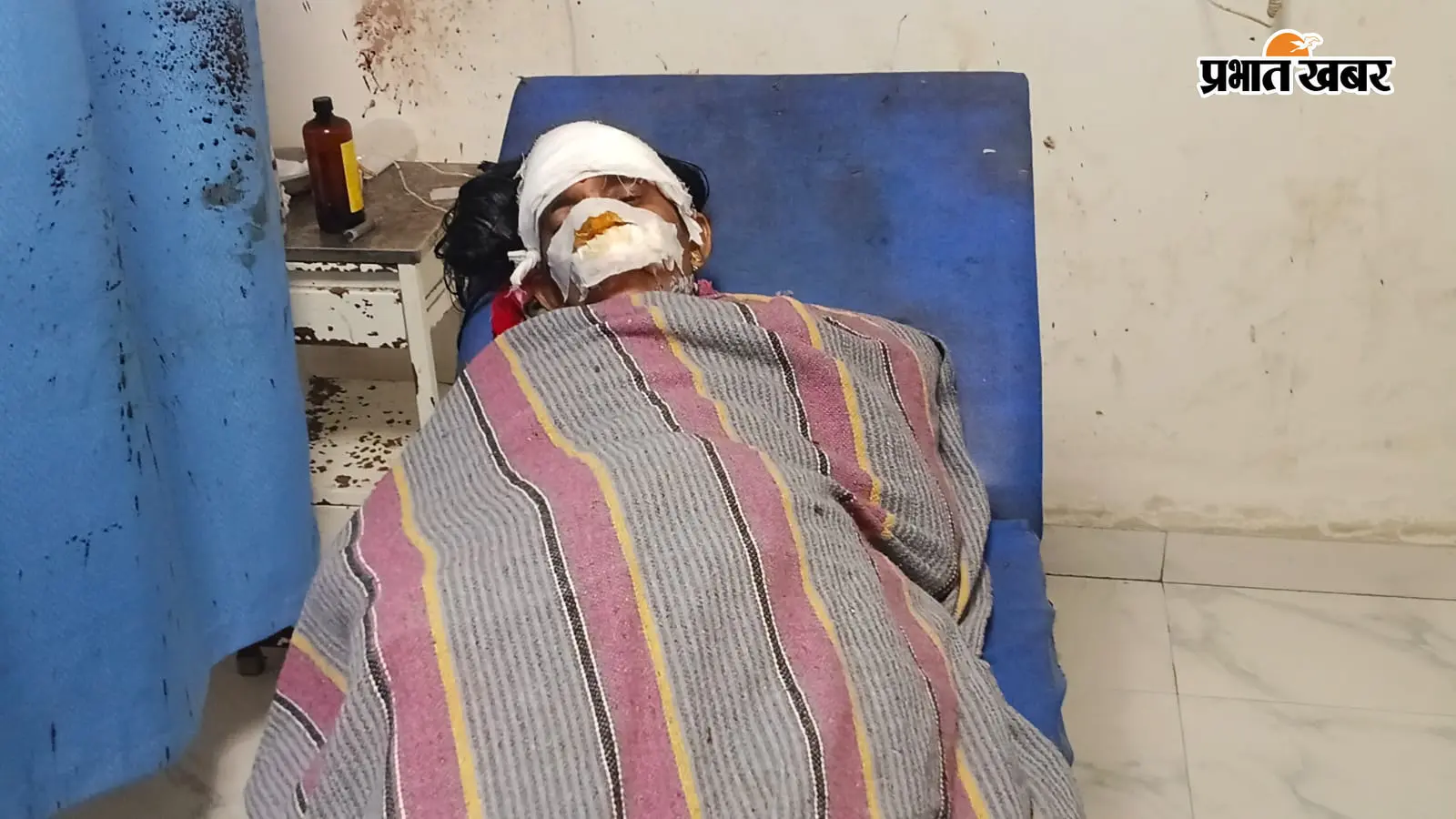 सीवान के गोठी गांव में सियार ने महिला पर किया हमला, शौच के लिए निकली थी; काटने से गंभीर घायल