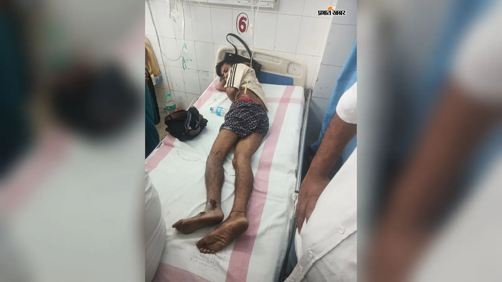 बक्सर में चोरी की पल्सर लेकर भाग रहा था चोर, मामा-भांजे को टक्कर मारकर भागने की कोशिश नाकाम