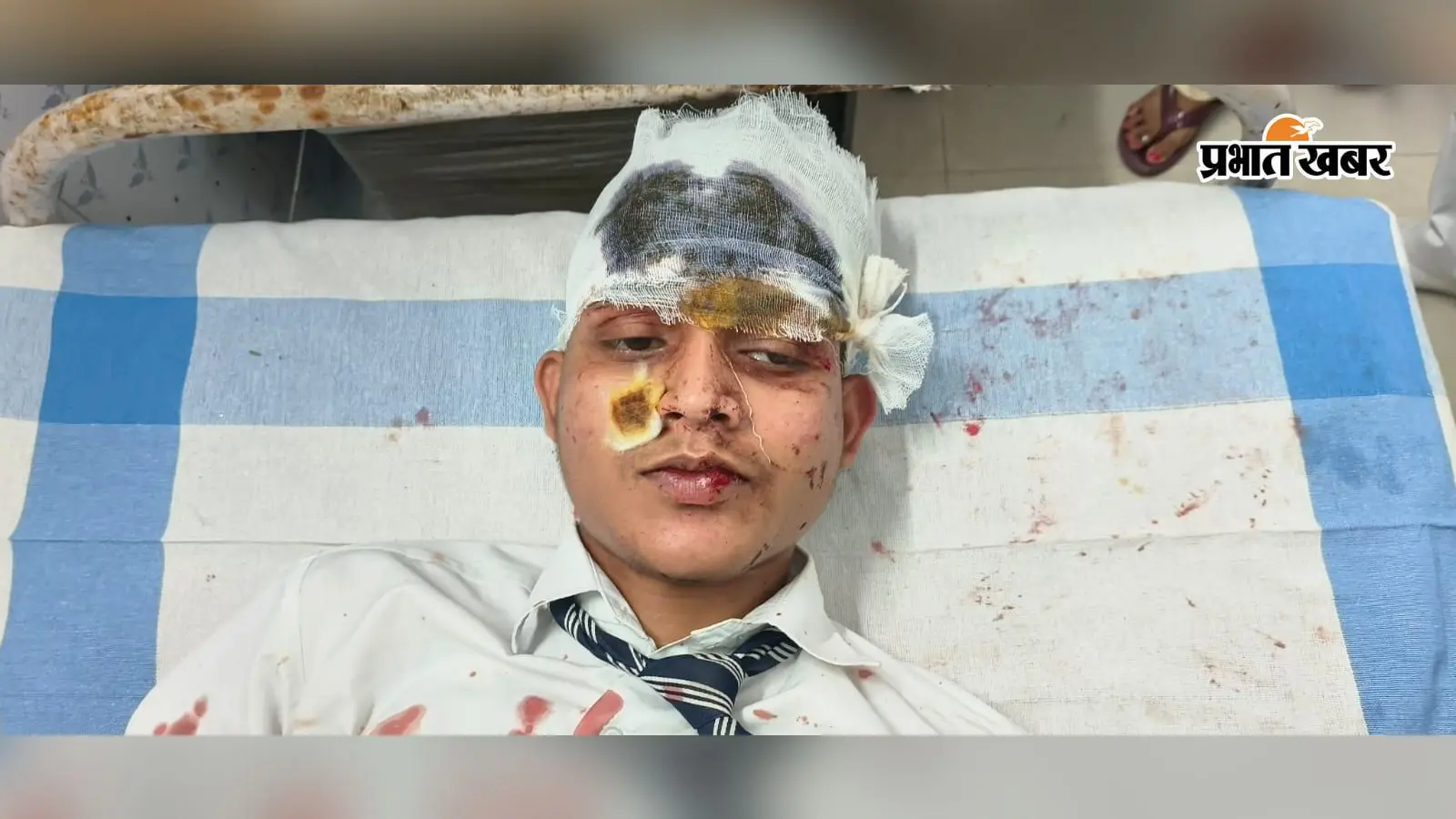 शेरघाटी में ई-रिक्शा और बुलेट की टक्कर, दो स्कूली छात्र घायल, चालक को भी लगी चोट
