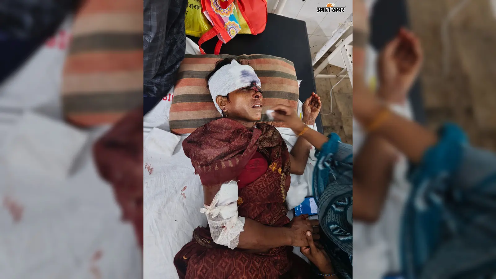 ओवरटेक के चक्कर में टोटो हादसा, डेढ़ साल के मासूम समेत दो गंभीर