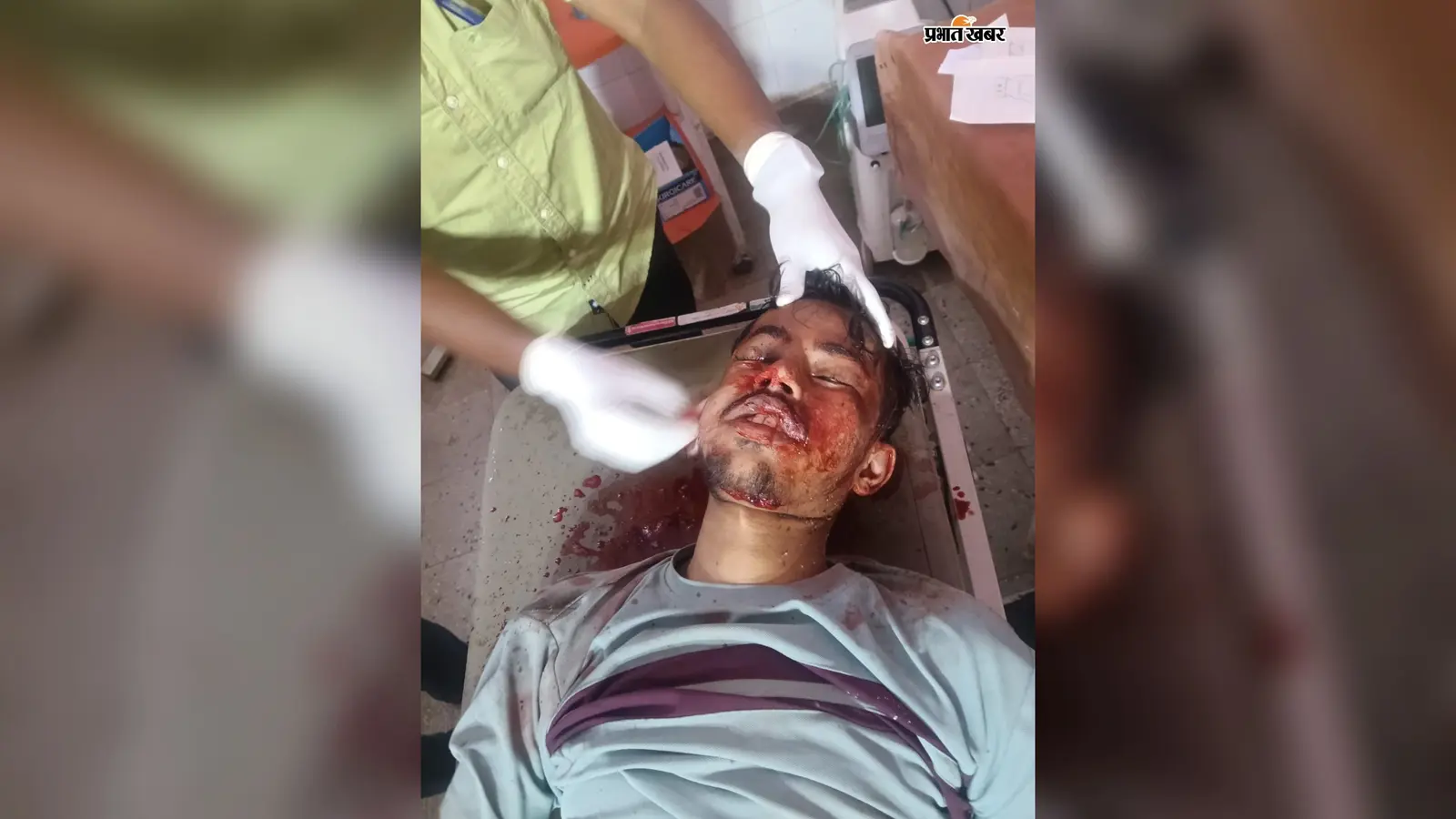 चंदवा में रेलवे ट्रैक किनारे गंभीर हालत में मिला युवक, ट्रेन से गिरने की आशंका