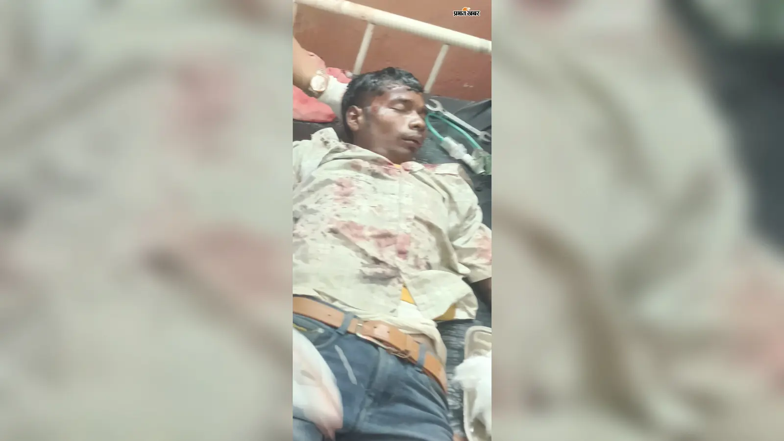 बालूमाथ में 20 घंटे में हाइवा की चपेट में आने से छह घायल, सड़क जाम