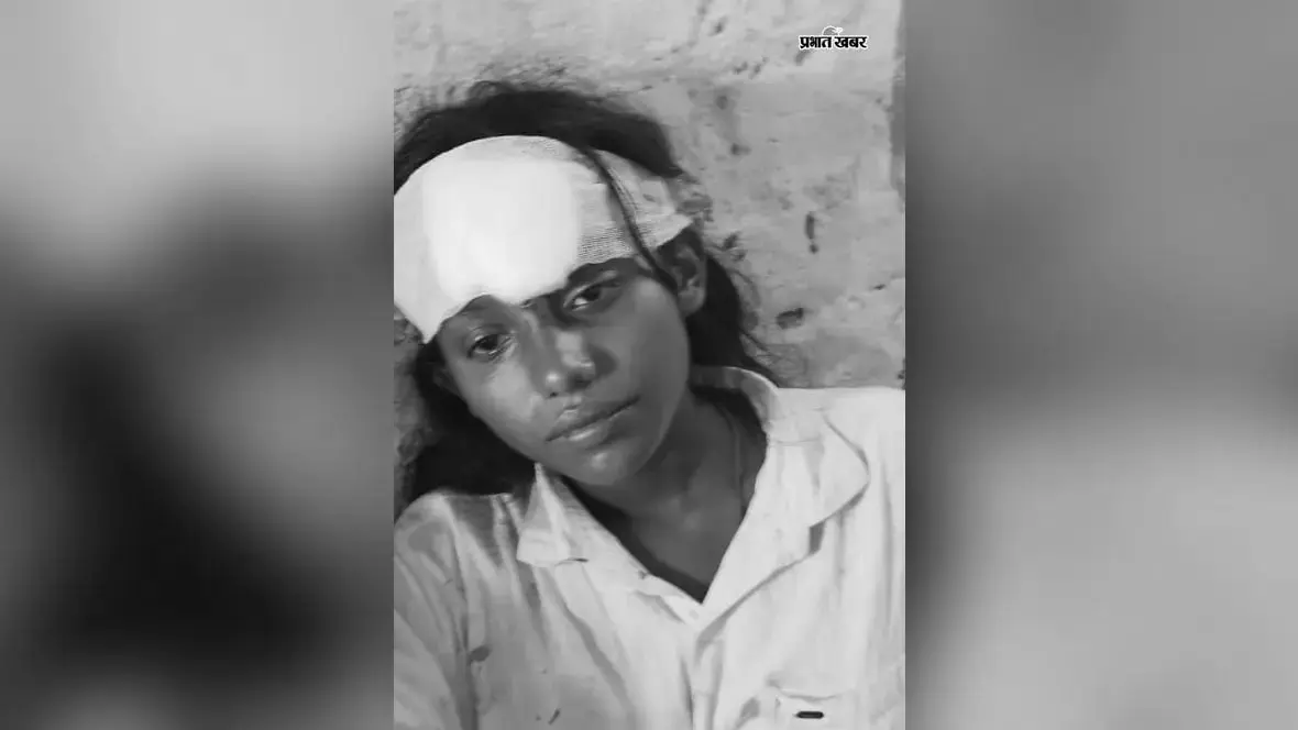 बिरनी में पानी के विवाद ने लिया खूनी रूप: कुएं से पानी भरने को लेकर भिड़े दो पक्ष, दर्जनभर घायल