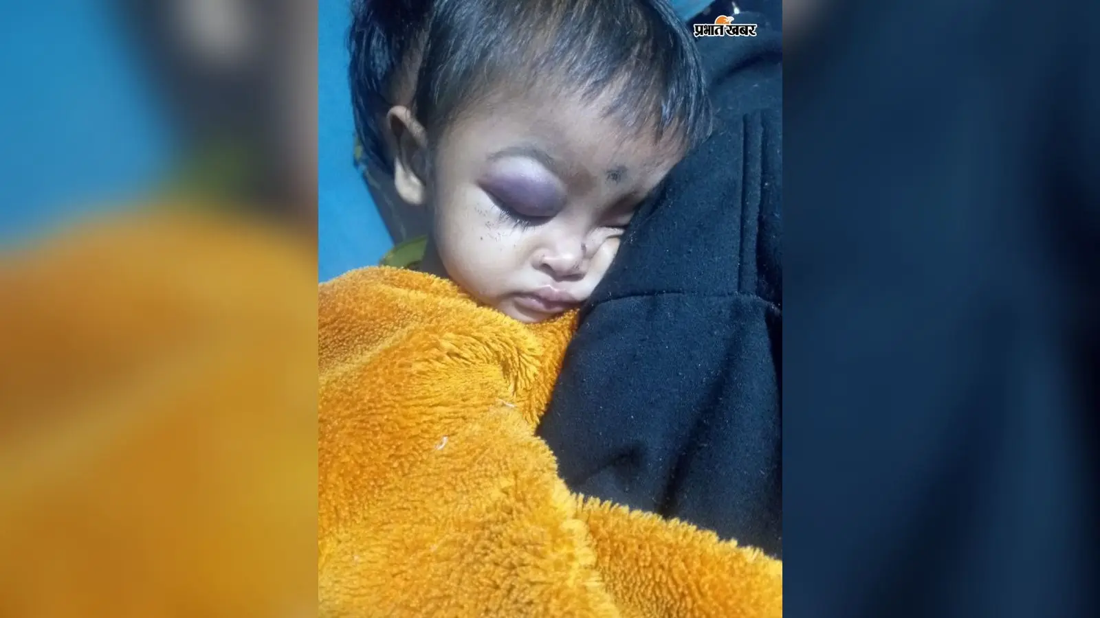 मांडर में दर्दनाक हादसा: ऑटो का इंतजार कर रही मां को बाइक ने मारी टक्कर, मौत