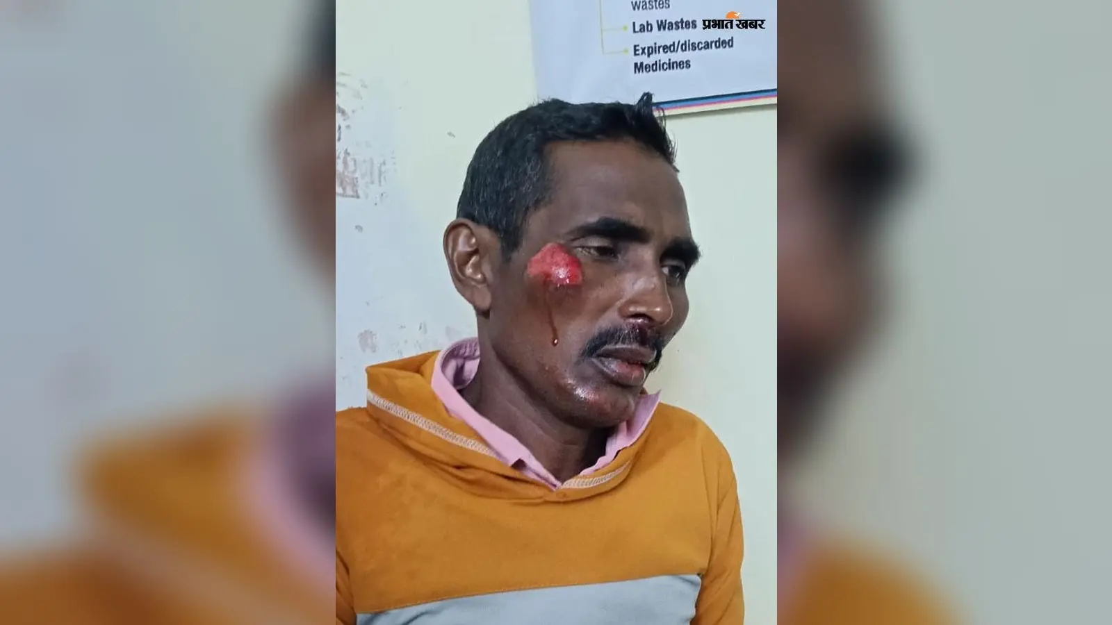 सिमरिया-बगरा मुख्य पथ पर बाइक जानवर से टकरायी, दो घायल; एक की हालत गंभीर